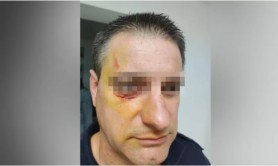 Polițist atacat de un refugiat într-un centru de cazare pentru imigranți. Ofițerul a avut nevoie de intervenția medicilor